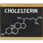 Die chemische Zusammensetzung von Cholesterin