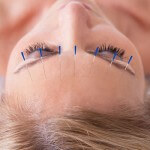Akupunktur ist eine in Deutschland sehr beliebte chinesische Heilmethode.